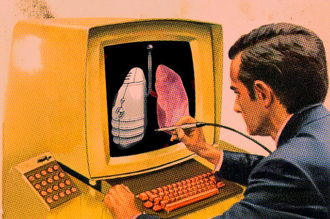 Pedir unos nuevos pulmones por Amazon no es posible, pero casi.